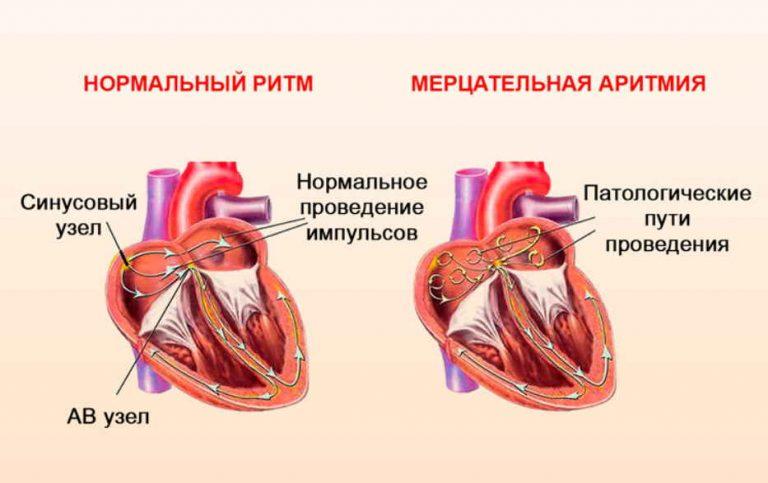 Мак биение сердца фото и описание